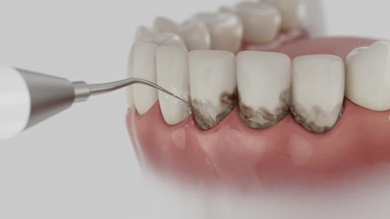 Trusted Wisdom Tooth Removal service in Luck, WI - Dentist Open Now